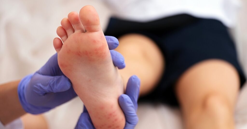 Exploring 5 covid 19 skin rashes: visuals, remedies, and expert advice