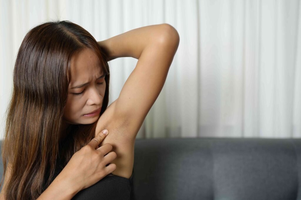 Top 10 causes of armpit rashes