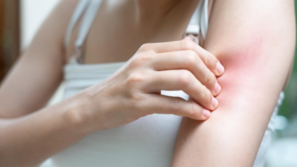 Beat monsoon skin woes: essential tips from a dermatologist