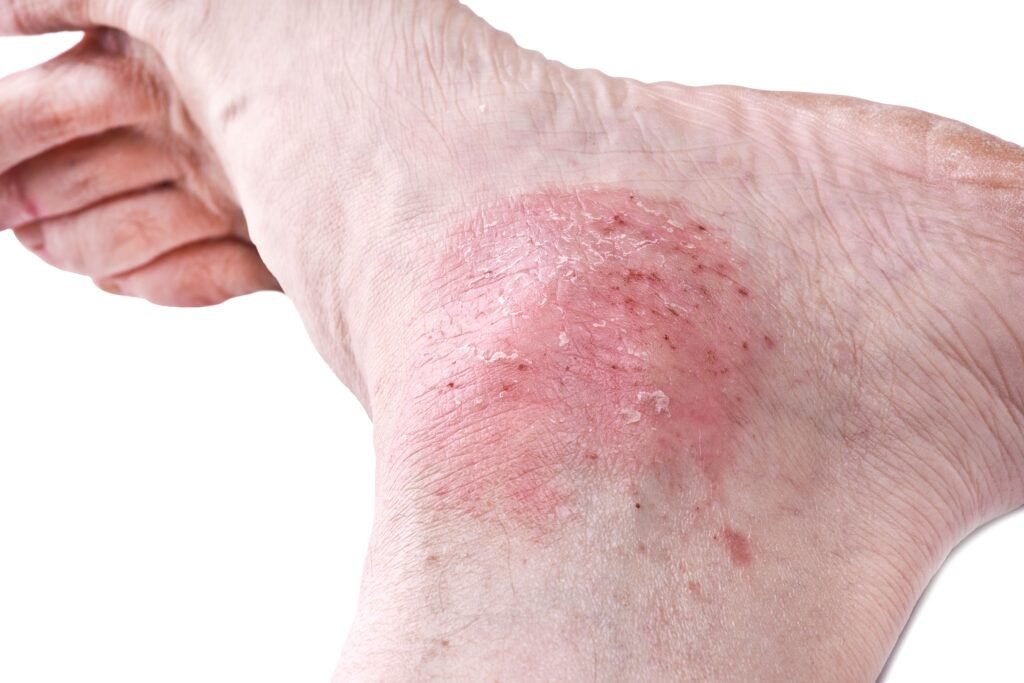 Enhancing diagnostic skills in podiatry: a study on dermatological lesions