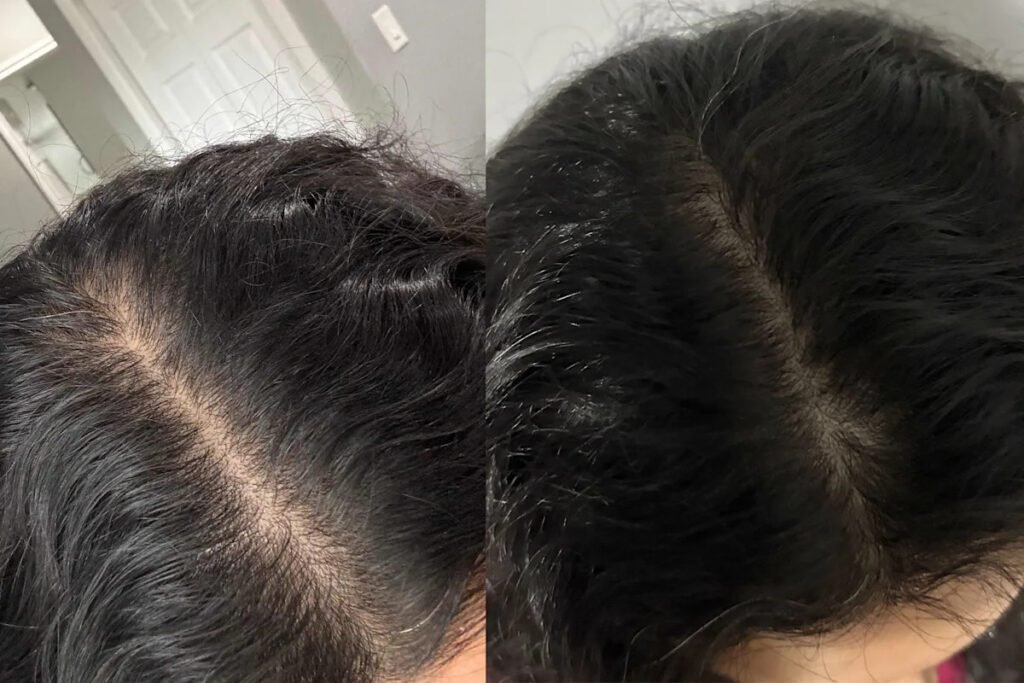 Essential tips and top products to combat women's hair thinning