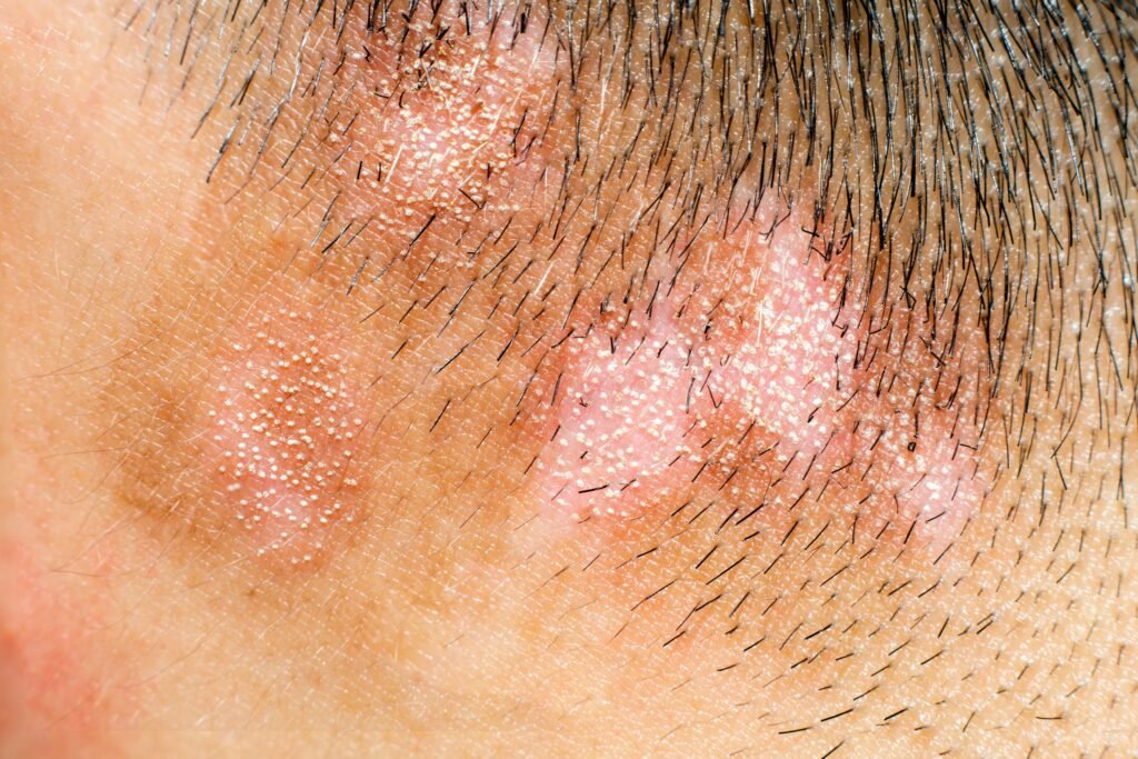 Evaluating facial pigment and inflammation: a device comparison
