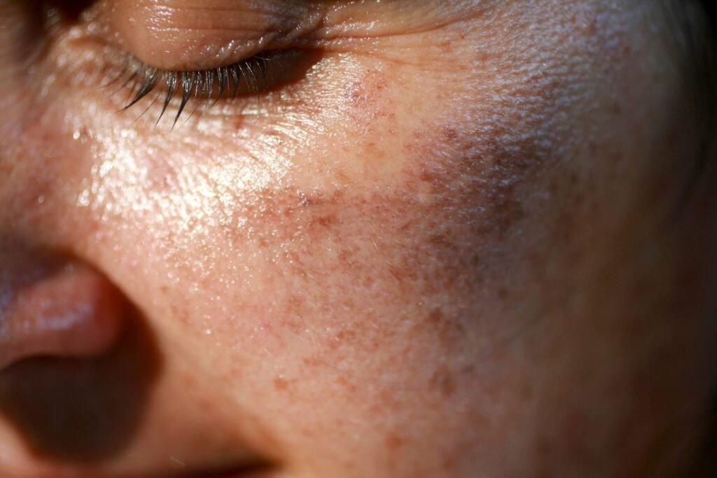 Exploring how environment impacts skin health