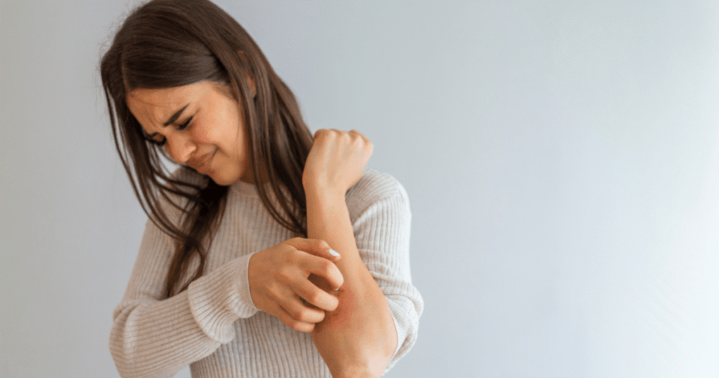 Signs you might have psoriasis