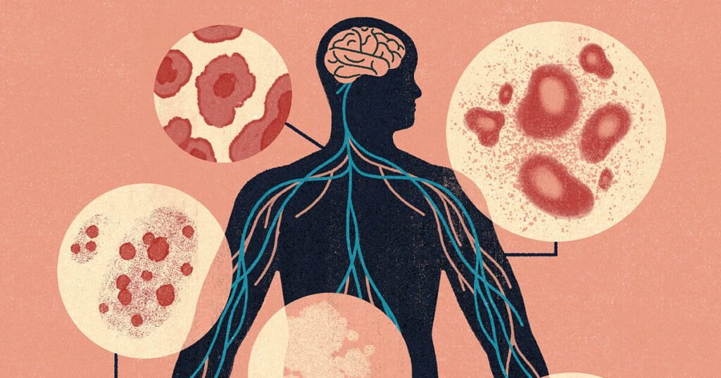 Skin issues could signal neurological disorders