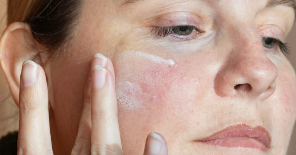 Top 19 rosacea solutions of 2025 recommended by dermatologists
