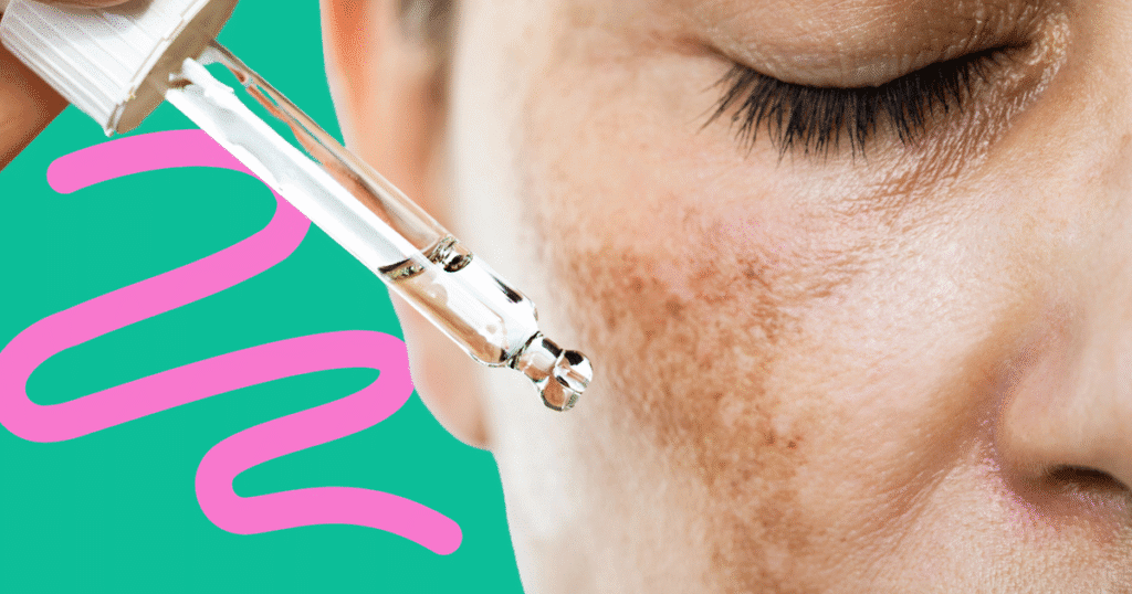 Top dermatologist picks for treating skin pigmentation