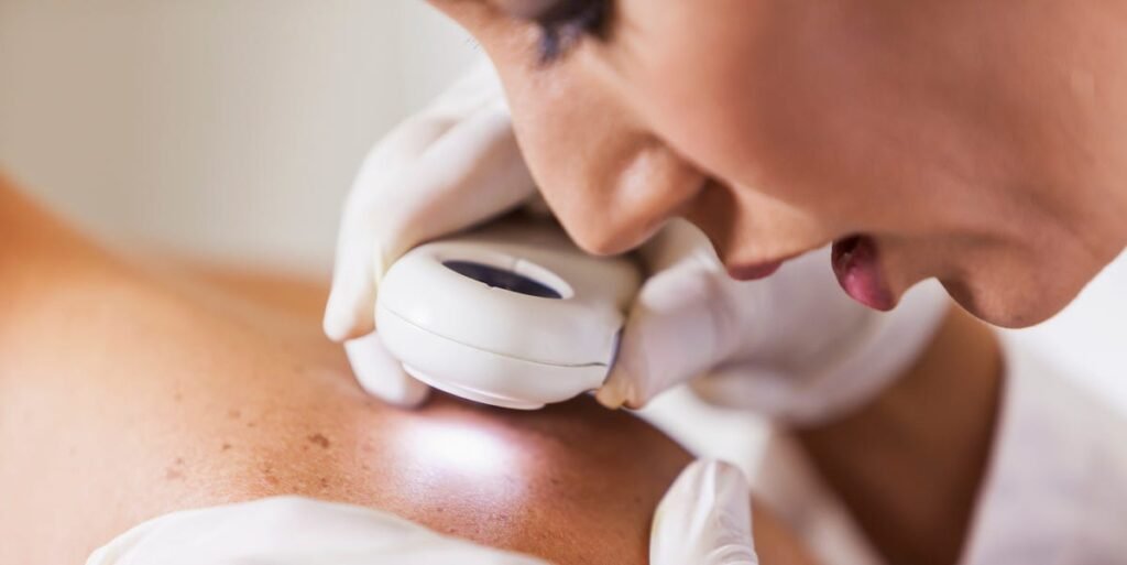 4 common skin conditions often misdiagnosed by doctors