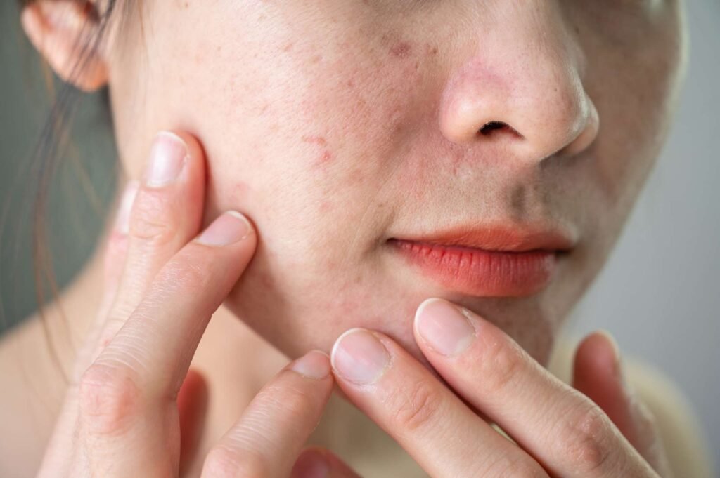 Revitalize your skin: 8 expert recommended treatments for perfect texture