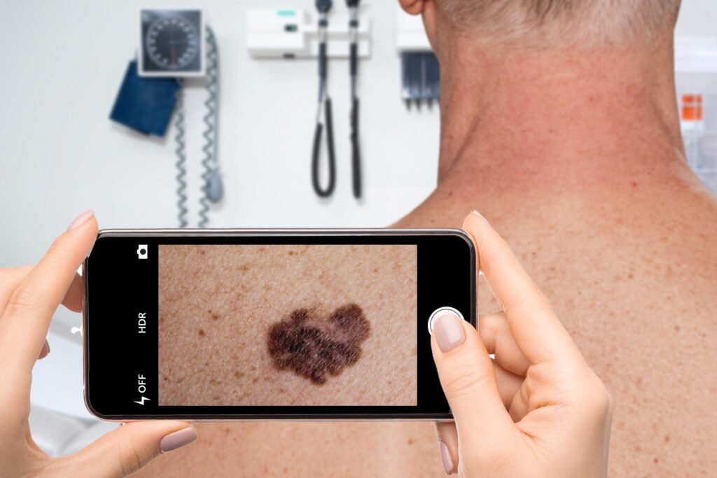 Revolutionary ai app diagnoses skin conditions instantly with your camera