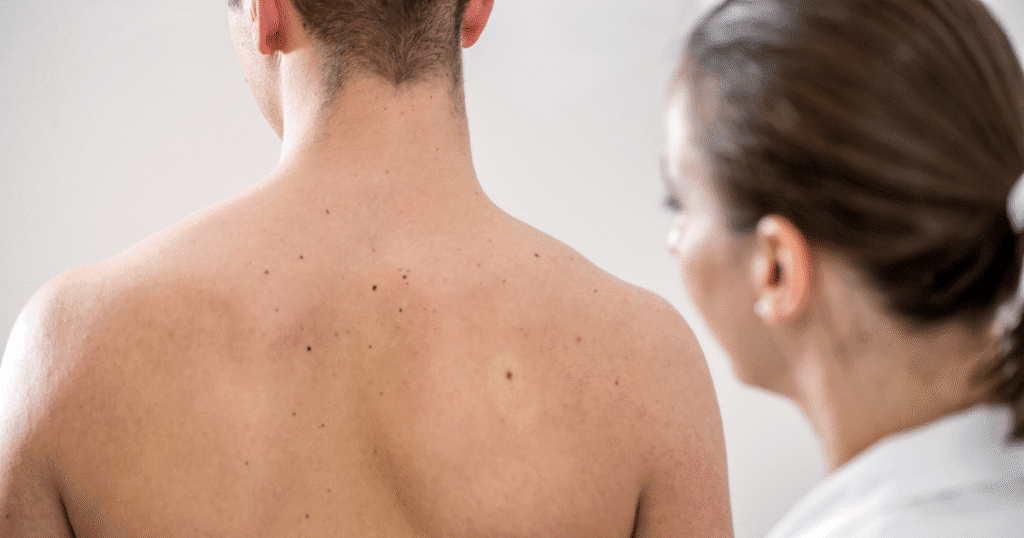 Revolutionizing melanoma detection with total body imaging
