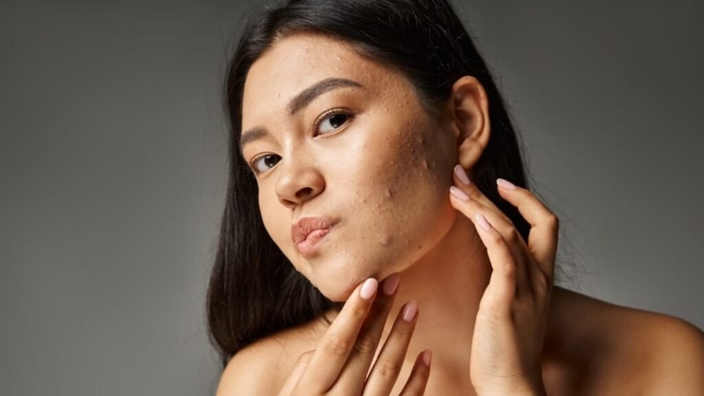 Unlocking skin secrets: 5 dermatologist identified clues to your health