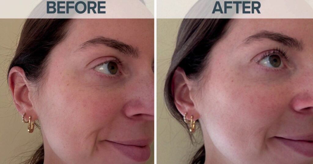 Unlocking the power of peptides: a dermatologist's guide to skin